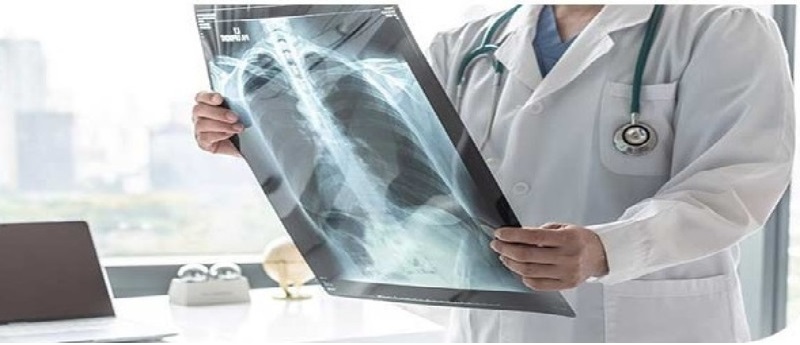 Digital X-Ray Services At Home