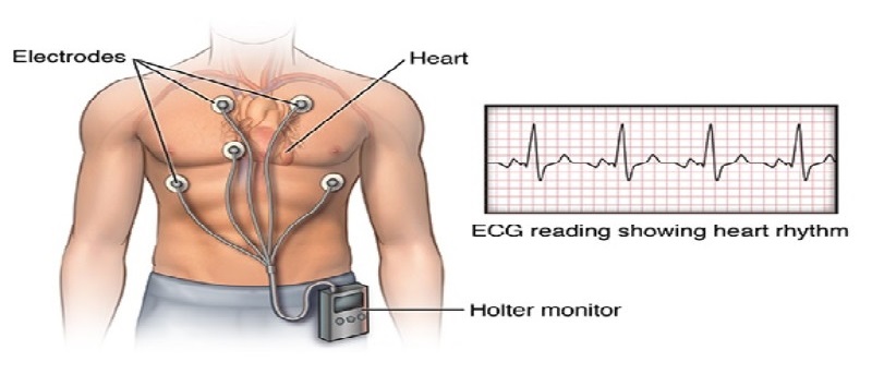ECG and Holter service at home