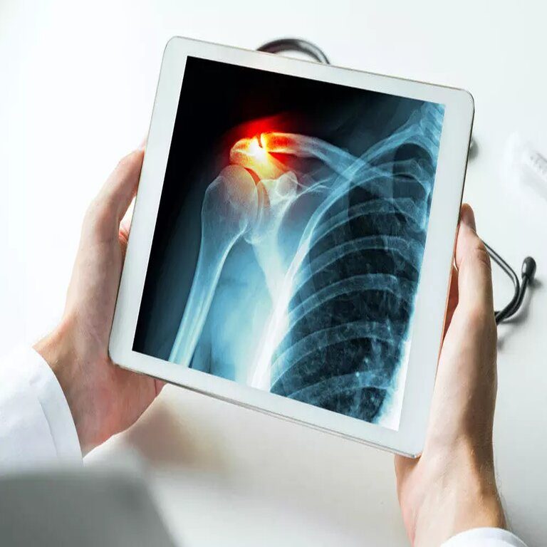 Digital X-Ray Services At Home