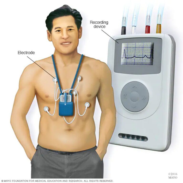 ECG & Holter At Home